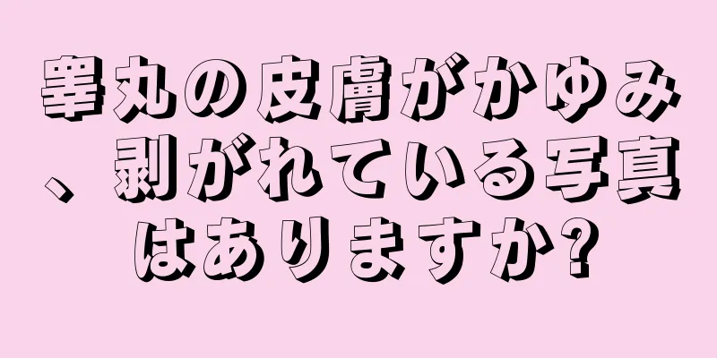 睾丸の皮膚がかゆみ、剥がれている写真はありますか?