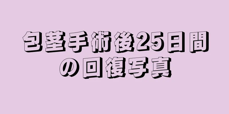 包茎手術後25日間の回復写真