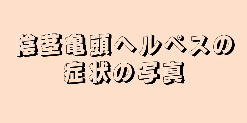 陰茎亀頭ヘルペスの症状の写真