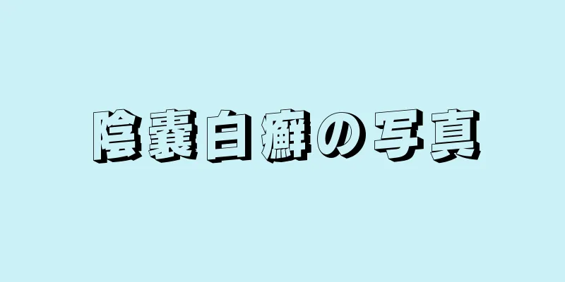 陰嚢白癬の写真