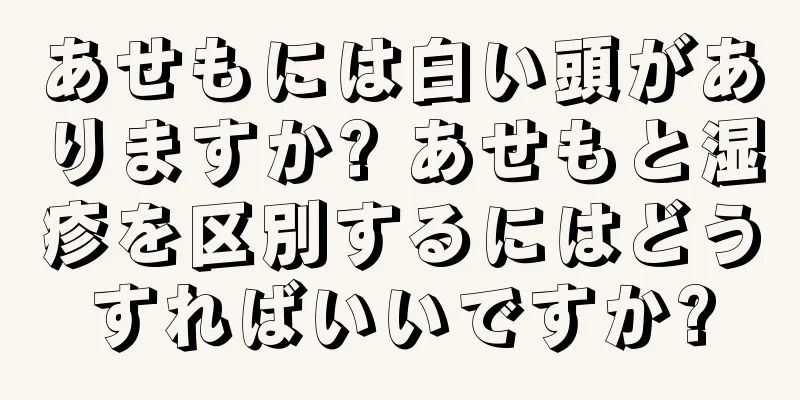 あせもには白い頭がありますか? あせもと湿疹を区別するにはどうすればいいですか?